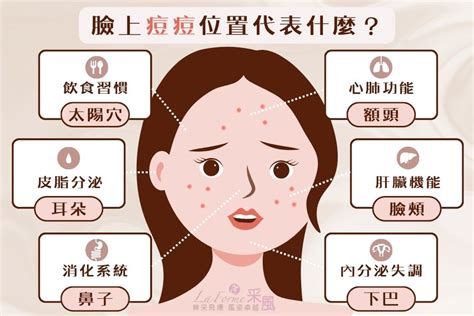 女生長痘痘|為什麼臉上痘痘一直長？醫授5步驟消除痘痘、避免毛。